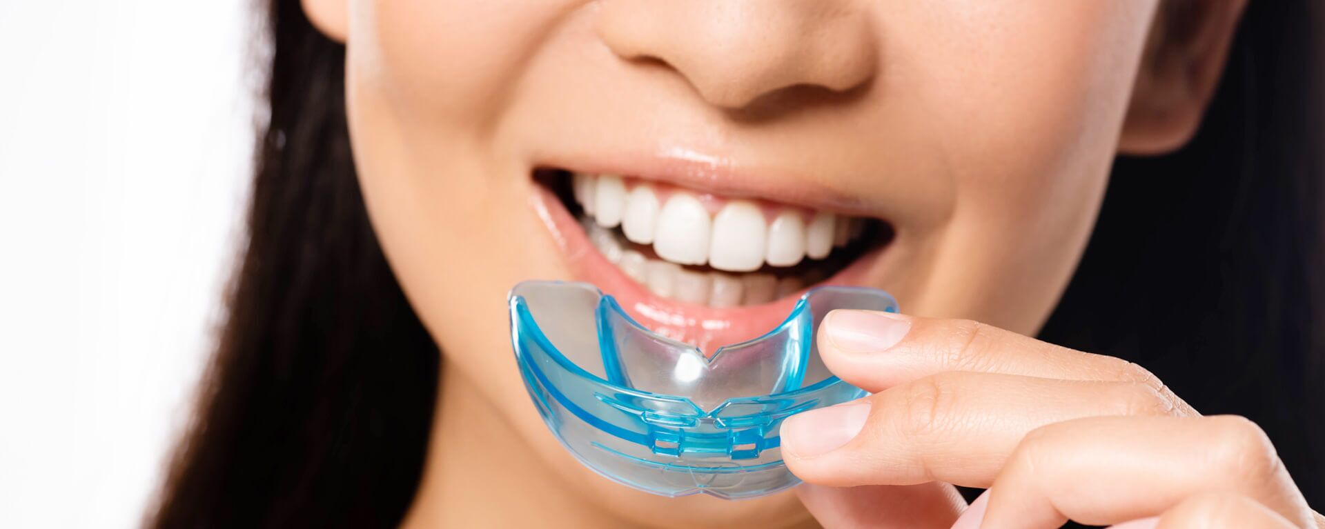Mouth Guards - Braceplace Orthodontics